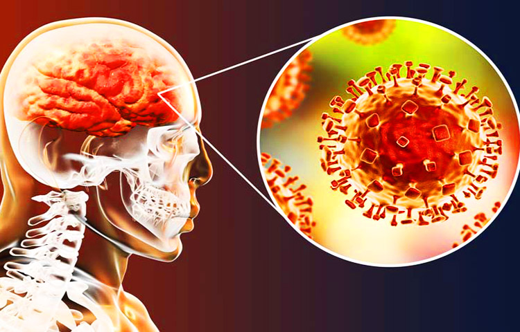 Diferencias entre meningitis viral y bacteriana