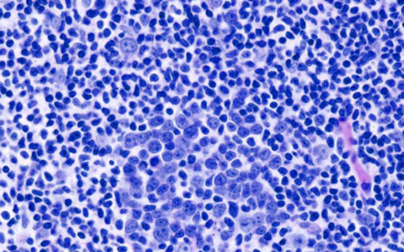 Diferencias entre células B y células T