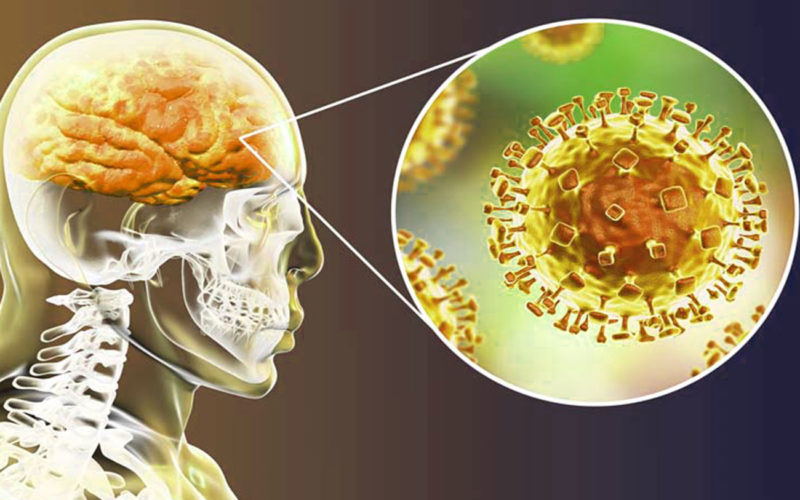 Diferencias entre encefalitis y meningitis