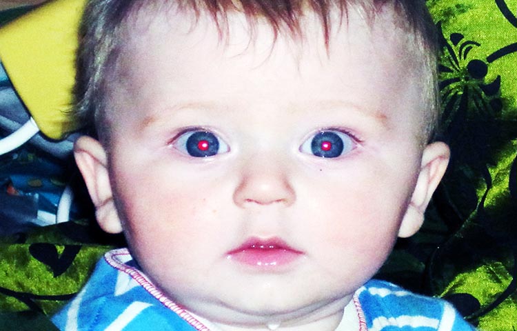 ojos aparecen rojos en una foto con flash