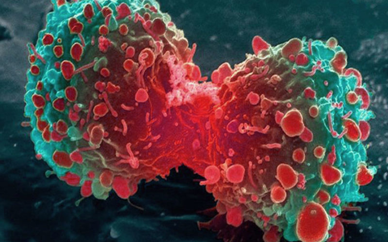 Diferencias entre célula normal y célula cancerosa