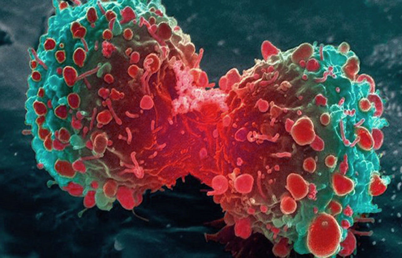 Diferencias entre célula normal y célula cancerosa