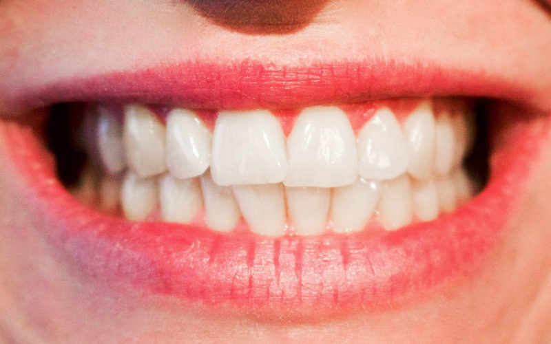 Diferencias entre dientes permanentes y dientes primarios