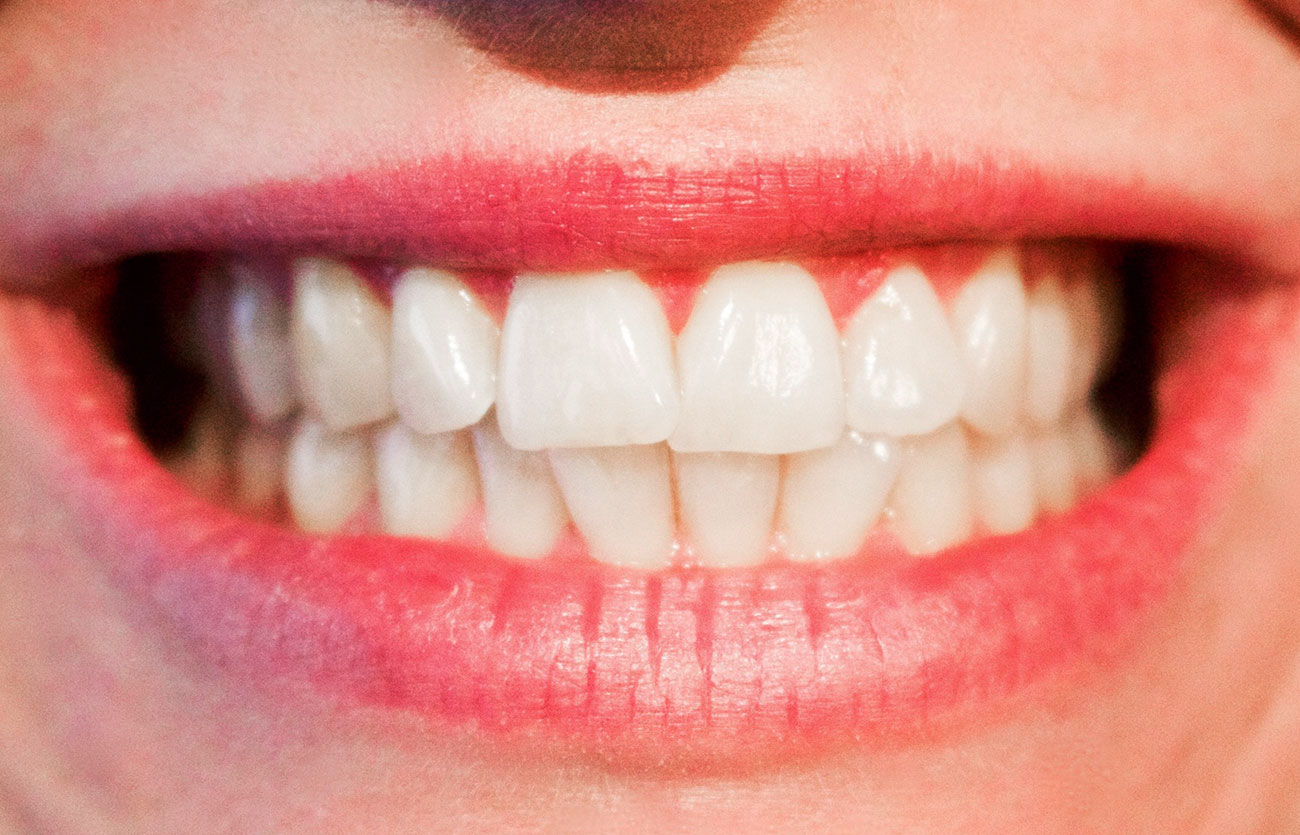 Diferencias entre dientes permanentes y dientes primarios