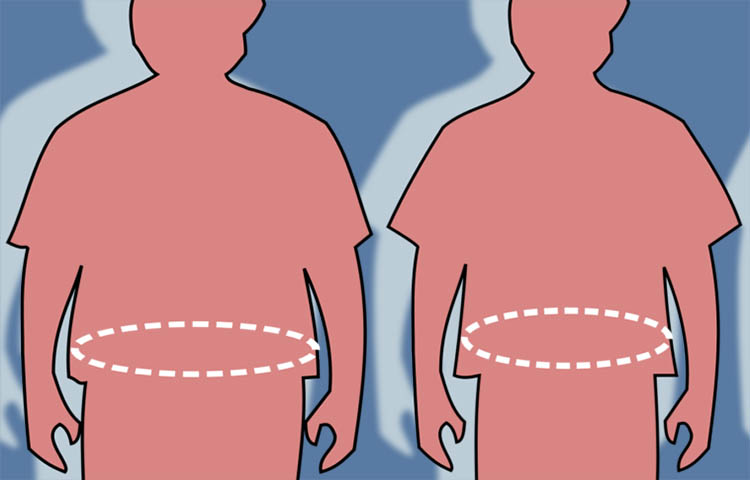 causas y sintomas de la acalasia