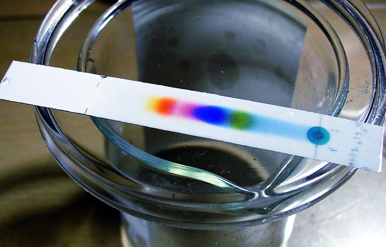 Diferencias entre electroforesis y cromatografía