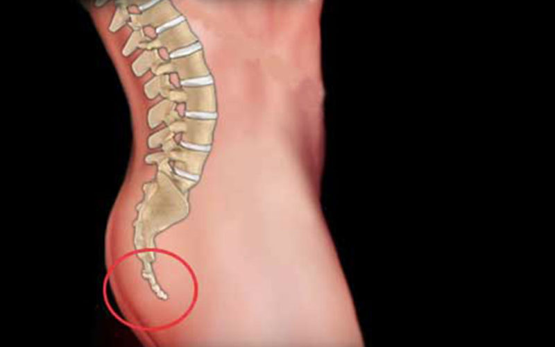 Diferencias entre coxis y sacro