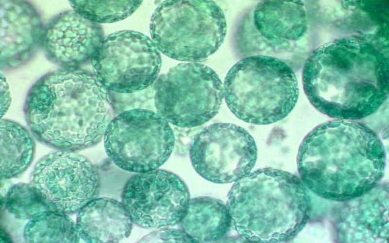 Diferencias entre el protoplasma y el protoplasto