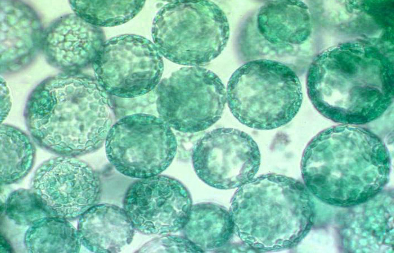 Diferencias entre el protoplasma y el protoplasto