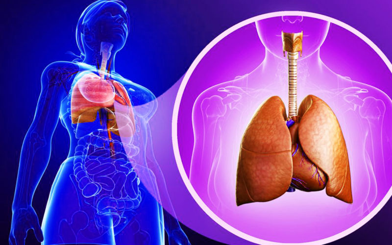 Diferencias entre la bronquiectasias y la bronquitis