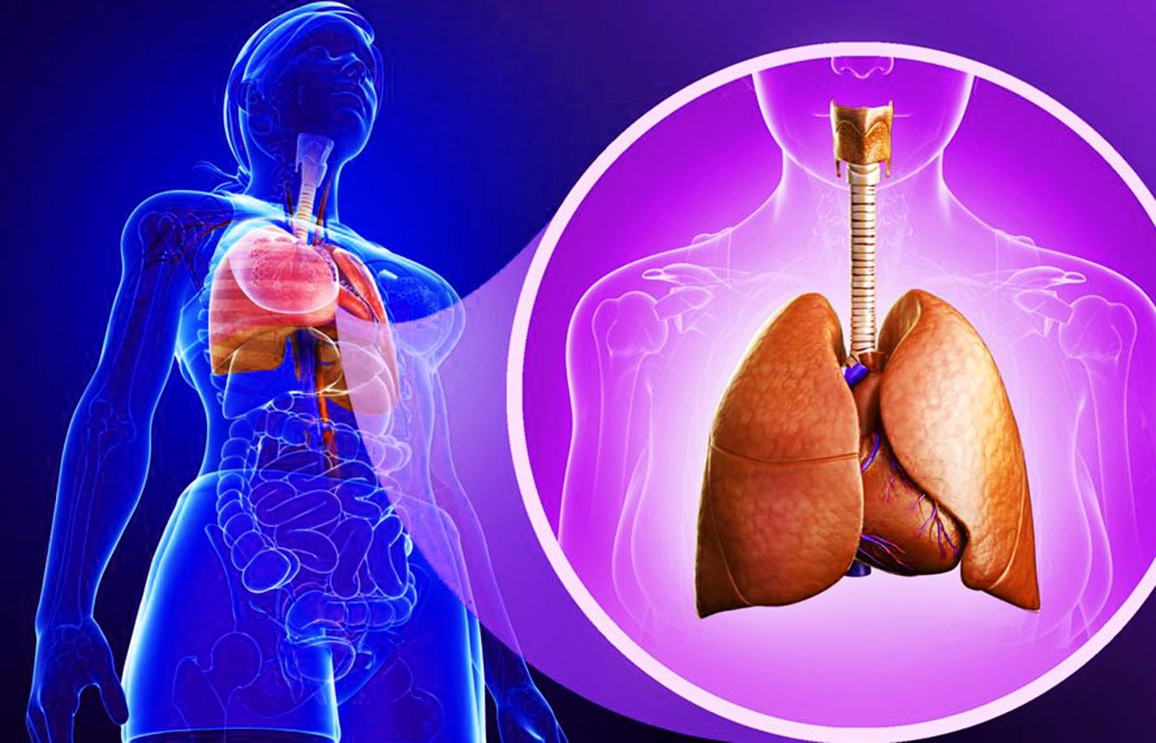 Diferencias entre la bronquiectasias y la bronquitis