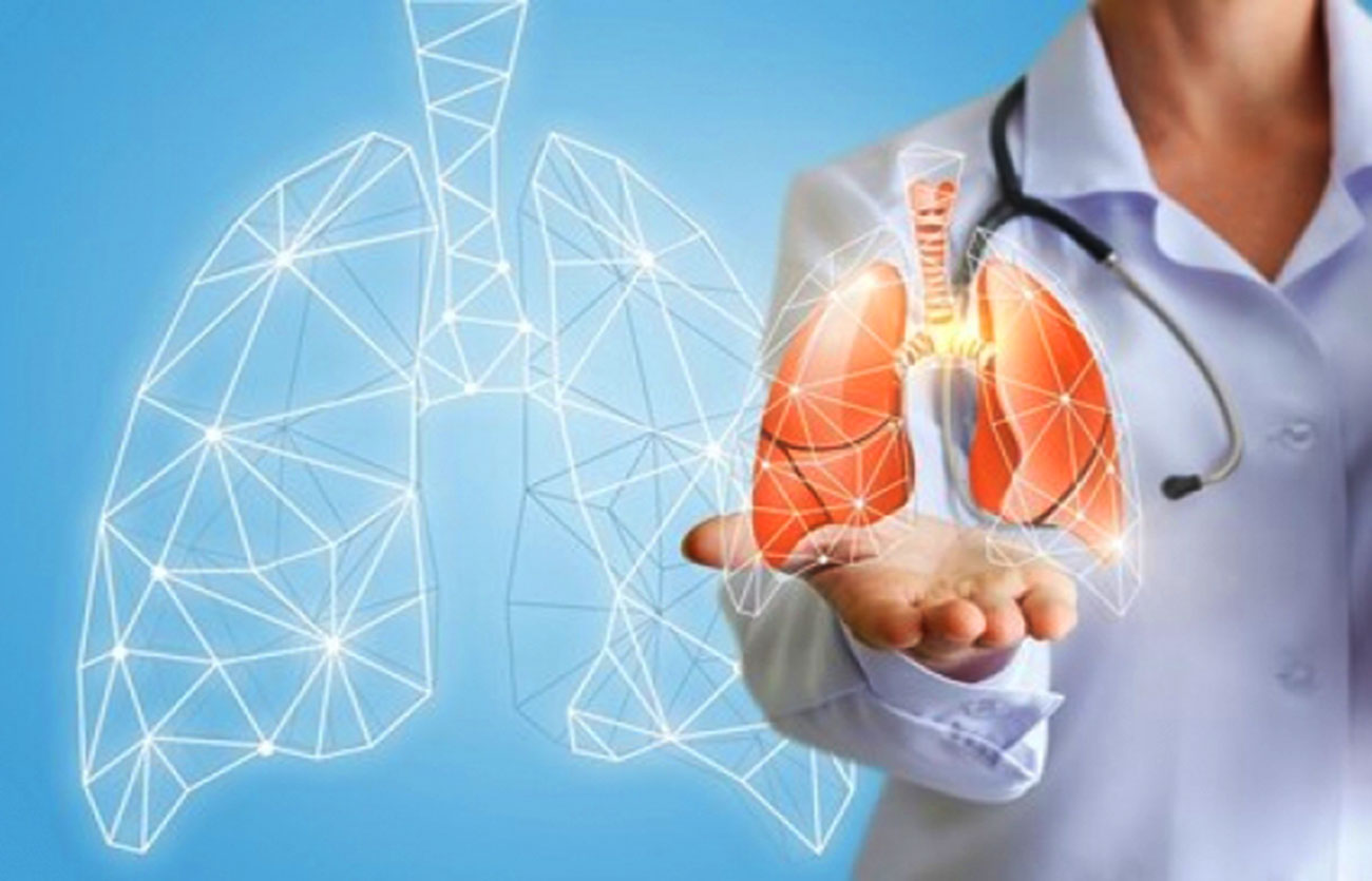 Diferencias entre la enfermedad pulmonar bronquiectasia y la enfermedad pulmonar intersticial