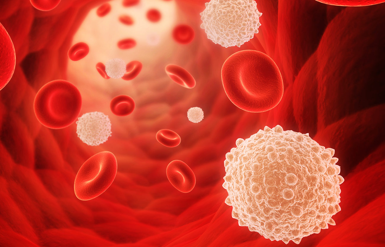 Diferencias entre la neutropenia y la leucopenia