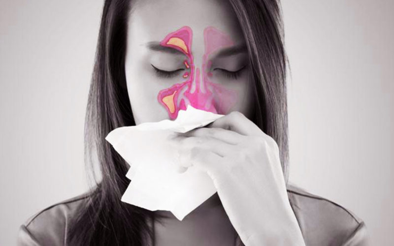 Diferencias entre la rinosinusitis y la sinusitis