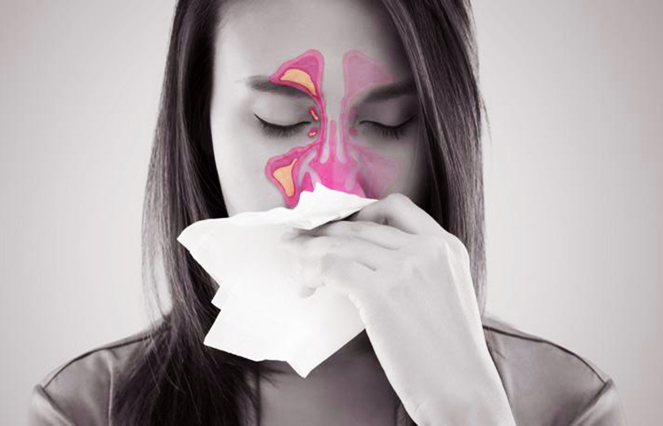 Diferencias entre la rinosinusitis y la sinusitis