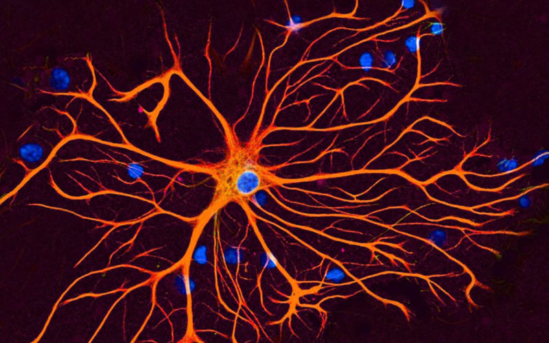 Diferencias entre las células gliales y las neuronas