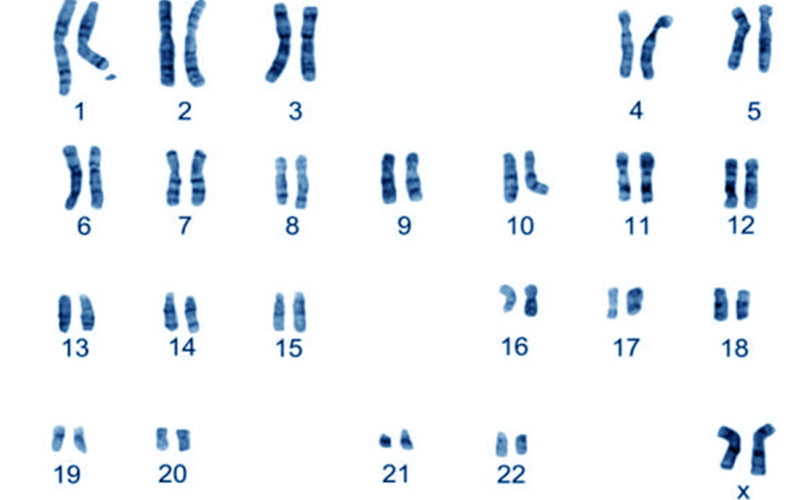 Diferencias entre los cariotipos femeninos y los cariotipos masculinos