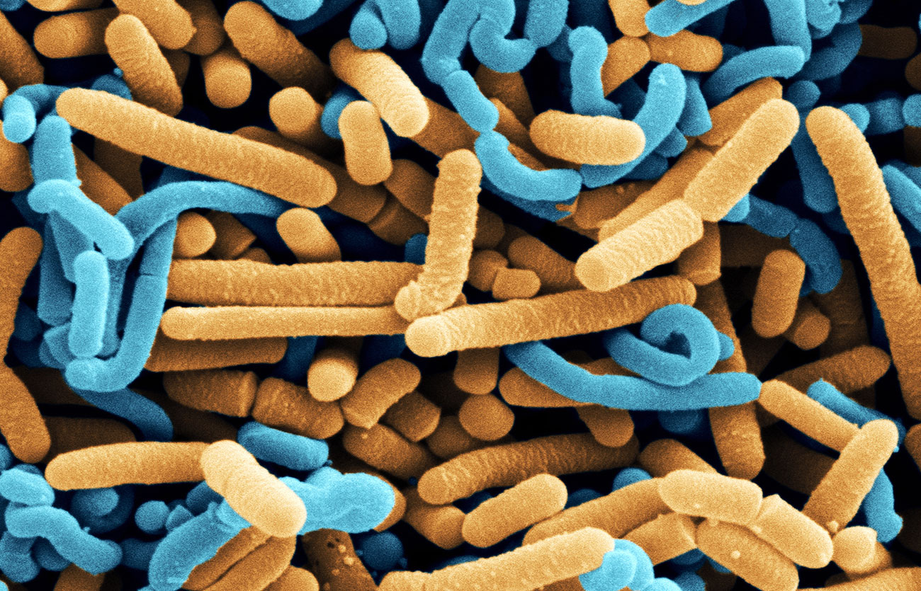 Diferencias entre los probióticos y los lactobacillus acidophilus