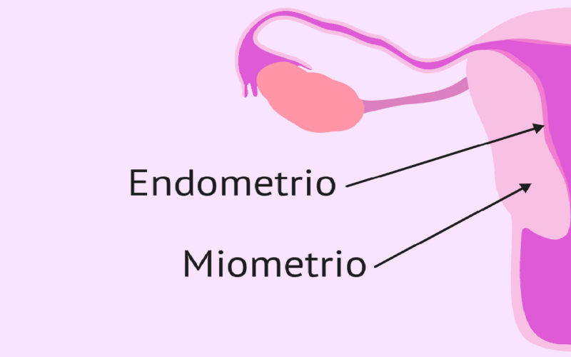 Diferencias entre miometrio y endometrio