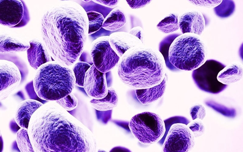 Diferencias entre síndrome mielodisplásico y trastorno mieloproliferativo