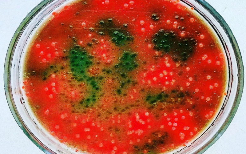 Diferencias entre P. aeruginosa y E. Coli