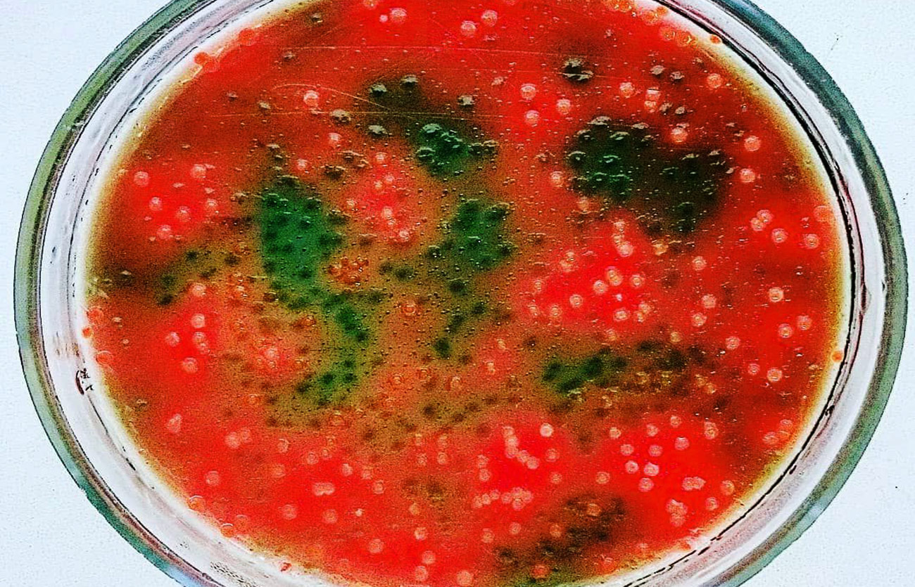 Diferencias entre P. aeruginosa y E. Coli