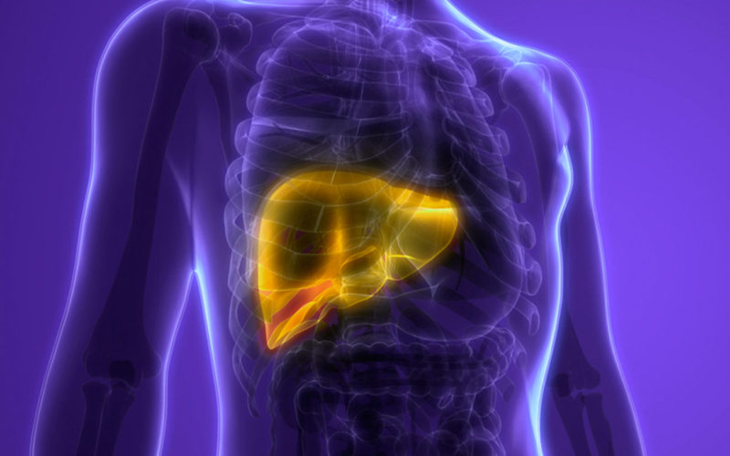 Diferencias entre la cirrosis y la fibrosis