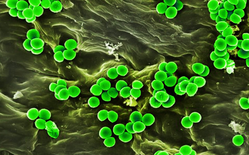 Diferencias entre la enterotoxina y la endotoxina