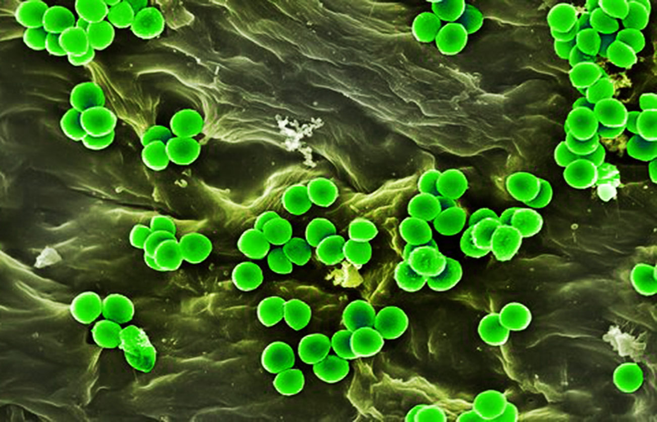 Diferencias entre la enterotoxina y la endotoxina