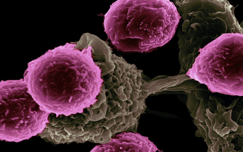 Diferencias entre las células B y las células T