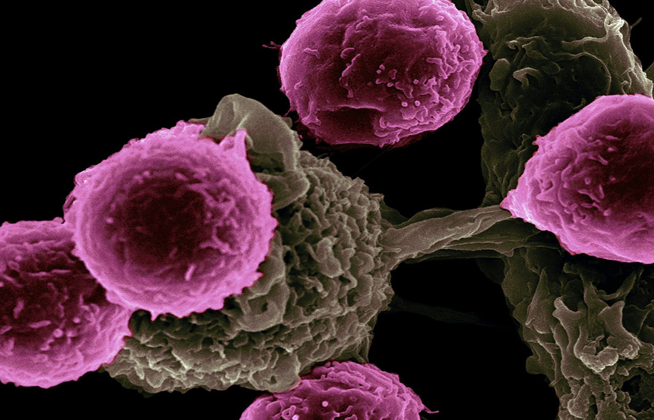 Diferencias entre las células B y las células T