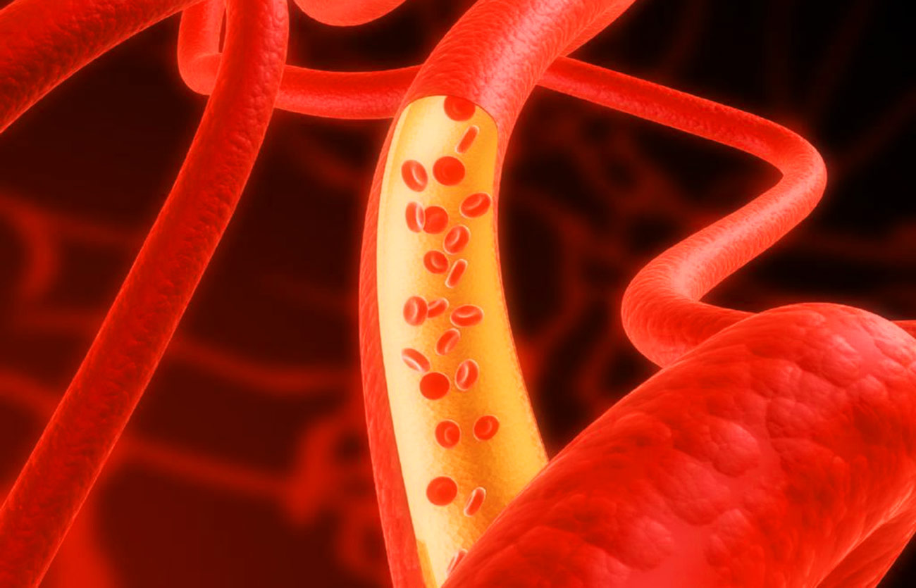 Diferencias entre la hemoglobina y el hierro