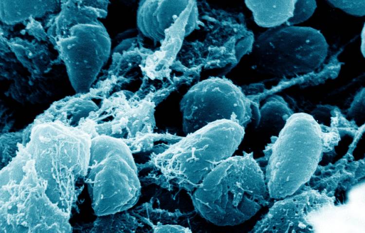 Diferencias entre microscopio óptico y microscopio electrónico