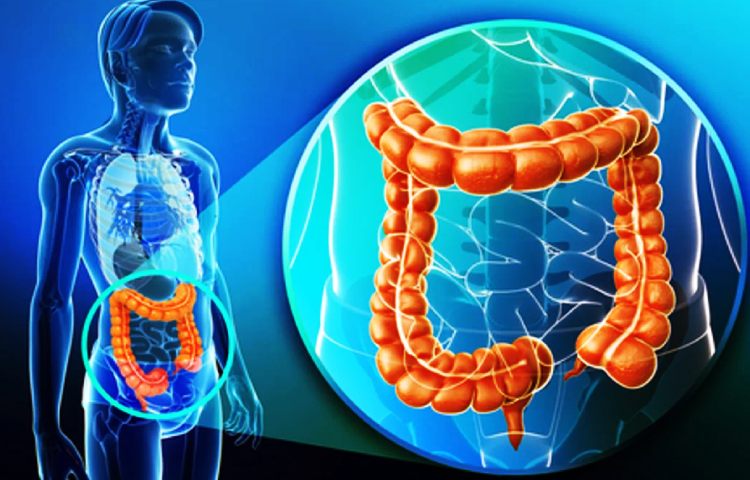 Diferencias entre colon e intestino grueso