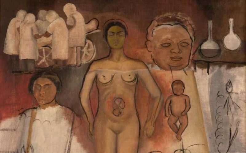 Quién fue el pintor de Frida y la cesárea