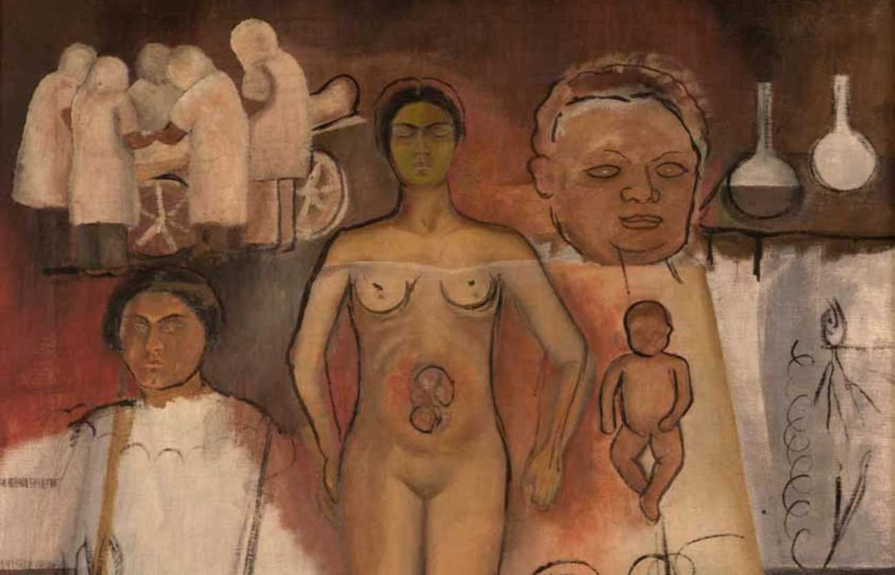 Quién fue el pintor de Frida y la cesárea